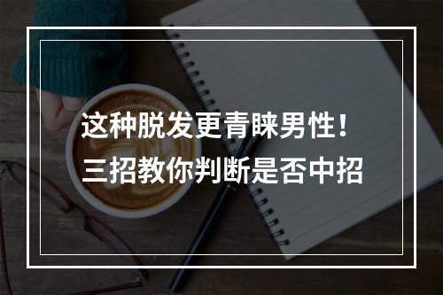 这种脱发更青睐男性！三招教你判断是否中招