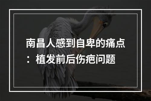 南昌人感到自卑的痛点：植发前后伤疤问题