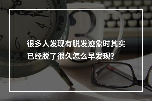 很多人发现有脱发迹象时其实已经脱了很久怎么早发现？