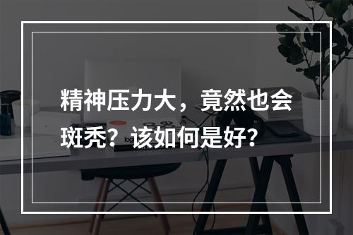 精神压力大，竟然也会斑秃？该如何是好？