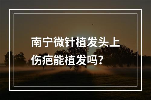 南宁微针植发头上伤疤能植发吗？