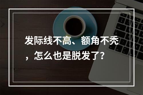 发际线不高、额角不秃，怎么也是脱发了？