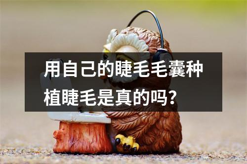 用自己的睫毛毛囊种植睫毛是真的吗？