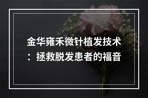 金华雍禾微针植发技术：拯救脱发患者的福音