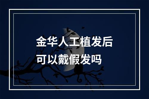 金华人工植发后可以戴假发吗