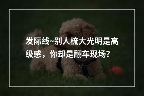 发际线~别人梳大光明是高级感，你却是翻车现场？