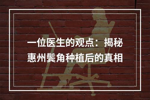 一位医生的观点：揭秘惠州鬓角种植后的真相