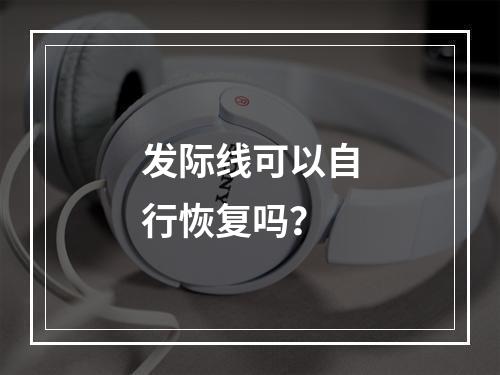 发际线可以自行恢复吗？