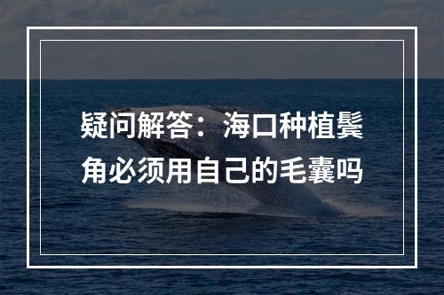 疑问解答：海口种植鬓角必须用自己的毛囊吗