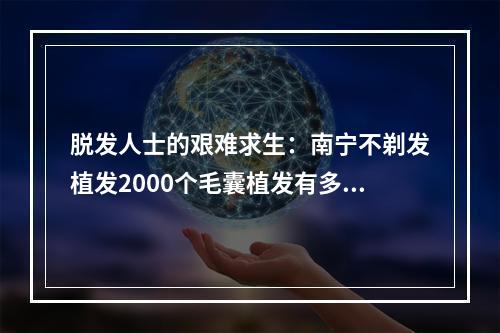 脱发人士的艰难求生：南宁不剃发植发2000个毛囊植发有多大面积