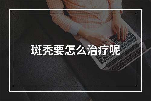 斑秃要怎么治疗呢