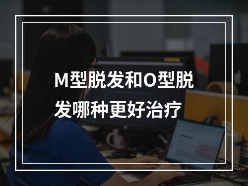 M型脱发和O型脱发哪种更好治疗