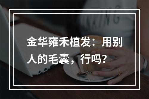 金华雍禾植发：用别人的毛囊，行吗？