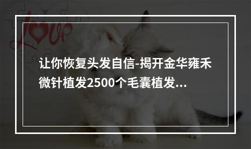 让你恢复头发自信-揭开金华雍禾微针植发2500个毛囊植发有多大面积