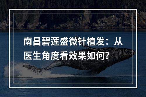 南昌碧莲盛微针植发：从医生角度看效果如何？