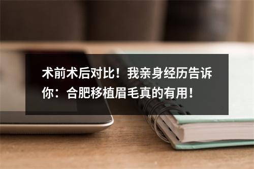 术前术后对比！我亲身经历告诉你：合肥移植眉毛真的有用！