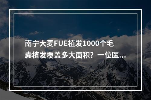 南宁大麦FUE植发1000个毛囊植发覆盖多大面积？一位医生的解答