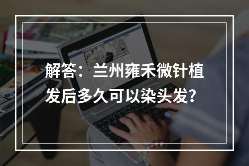 解答：兰州雍禾微针植发后多久可以染头发？