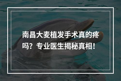 南昌大麦植发手术真的疼吗？专业医生揭秘真相！