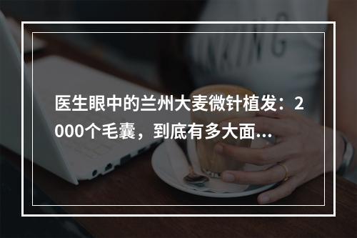 医生眼中的兰州大麦微针植发：2000个毛囊，到底有多大面积？