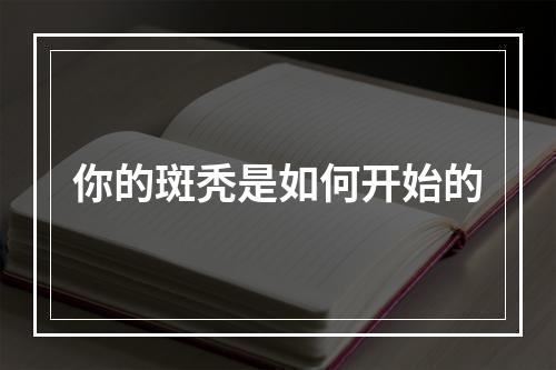 你的斑秃是如何开始的