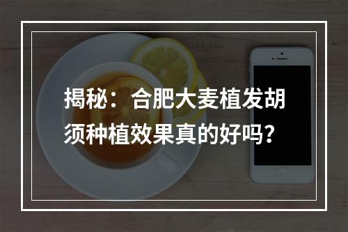 揭秘：合肥大麦植发胡须种植效果真的好吗？