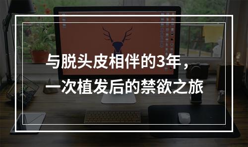 与脱头皮相伴的3年，一次植发后的禁欲之旅