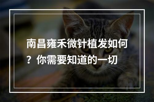 南昌雍禾微针植发如何？你需要知道的一切