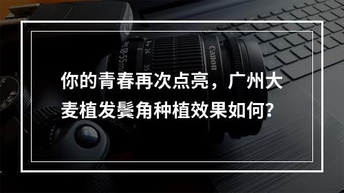 你的青春再次点亮，广州大麦植发鬓角种植效果如何？