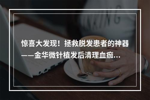 惊喜大发现！拯救脱发患者的神器——金华微针植发后清理血痂经验分享