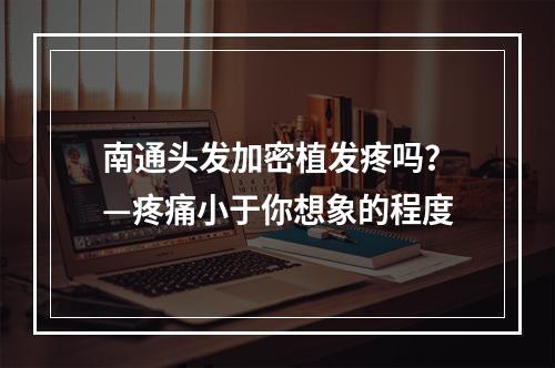 南通头发加密植发疼吗？—疼痛小于你想象的程度