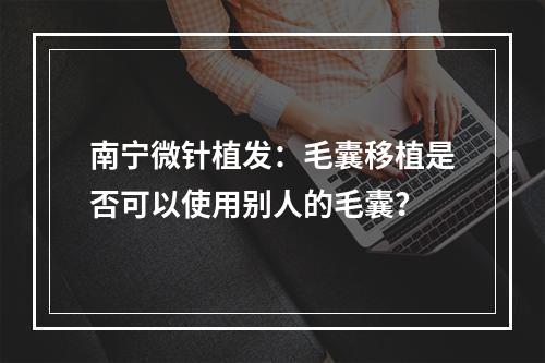 南宁微针植发：毛囊移植是否可以使用别人的毛囊？