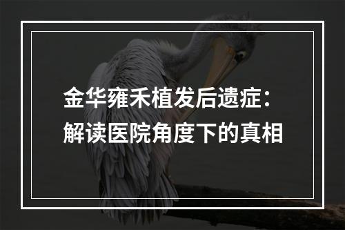 金华雍禾植发后遗症：解读医院角度下的真相