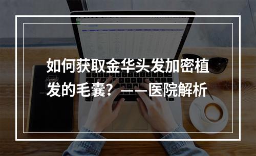 如何获取金华头发加密植发的毛囊？——医院解析