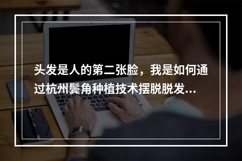 头发是人的第二张脸，我是如何通过杭州鬓角种植技术摆脱脱发困扰的