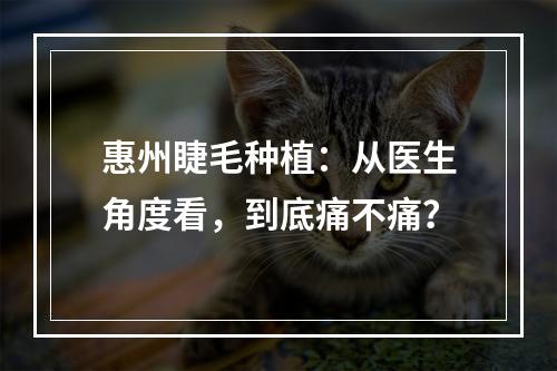 惠州睫毛种植：从医生角度看，到底痛不痛？