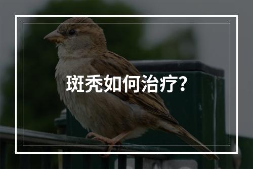 斑秃如何治疗？