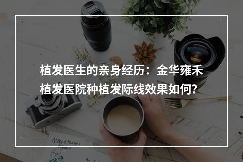 植发医生的亲身经历：金华雍禾植发医院种植发际线效果如何？