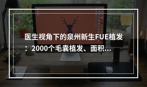 医生视角下的泉州新生FUE植发：2000个毛囊植发、面积有多大？