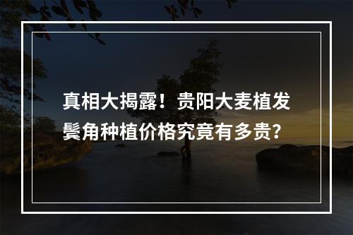 真相大揭露！贵阳大麦植发鬓角种植价格究竟有多贵？