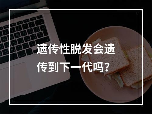 遗传性脱发会遗传到下一代吗？