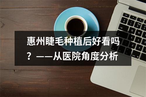 惠州睫毛种植后好看吗？——从医院角度分析