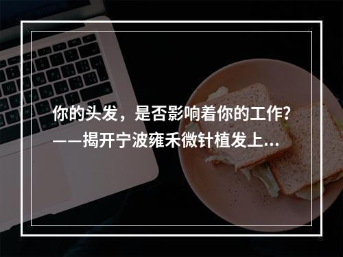 你的头发，是否影响着你的工作？——揭开宁波雍禾微针植发上班时间的神秘面纱