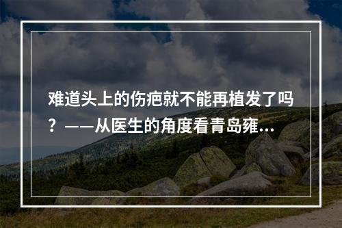 难道头上的伤疤就不能再植发了吗？——从医生的角度看青岛雍禾FUE植发