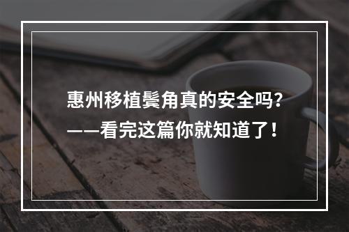 惠州移植鬓角真的安全吗？——看完这篇你就知道了！