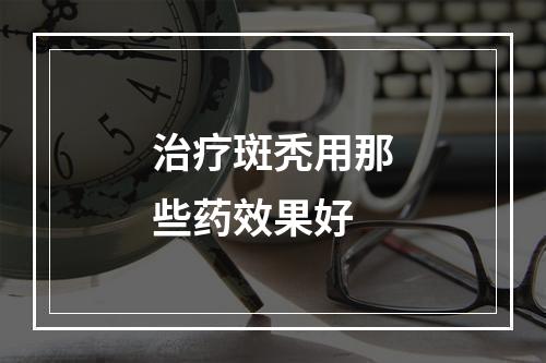 治疗斑秃用那些药效果好