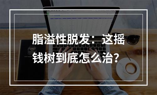 脂溢性脱发：这摇钱树到底怎么治？