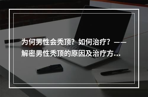 为何男性会秃顶？如何治疗？——解密男性秃顶的原因及治疗方案