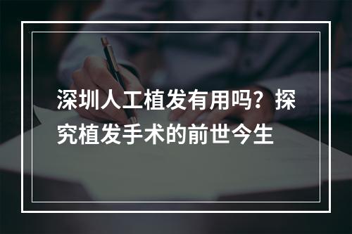 深圳人工植发有用吗？探究植发手术的前世今生