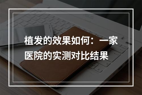 植发的效果如何：一家医院的实测对比结果